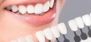 Lee más sobre el artículo Blanqueamiento Dental con Agua Oxigenada – ¿Es bueno para mis dientes?